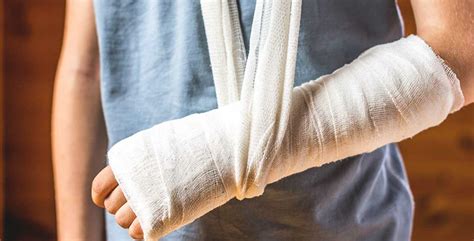 Broken Bones And Scarring Lawyers In Springfield Mo Rah Law