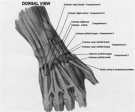 Corticosteroid Injection For Treatment Of De Quervains Tenosynovitis