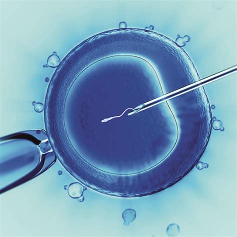 Intracytoplasmic Sperm Injectionicsi Treatment Fertility Center In India Dr Aravinds Ivf