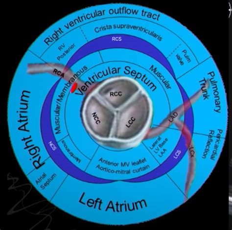 Aortic Valve Anatomy A Complete Exploration Drsvenkatesan Md