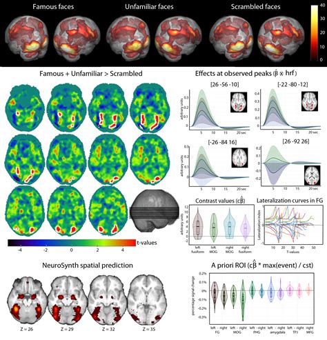 Best Practice For Fmri Displays Plots And Colour Maps