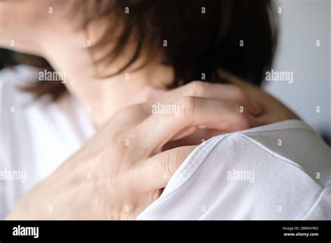 Scratch Skin Hi Res Stock Photography And Images Alamy