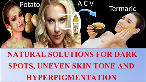 Natural Solutions For Dark Spots Uneven Skin Tone And