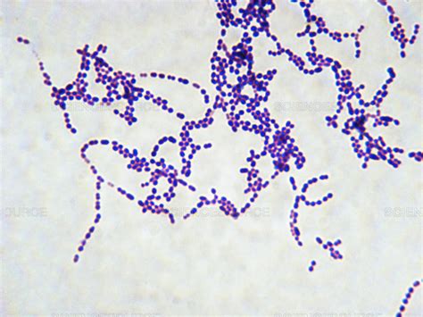 Streptococcus Streptokoklar Microbiology Laboratory Turkey