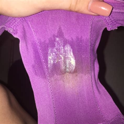 I Ve Never Seen My Underwear This Wet Before And Idk If My Discharge Looks Normal Does It Look