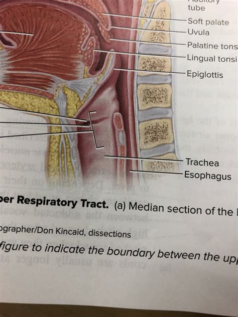 Trachea Vs Esophagus Practical 2 Diagram Quizlet