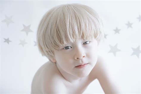 I Captured The Hypnotizing Beauty Of Albino People Part 2 Albinism