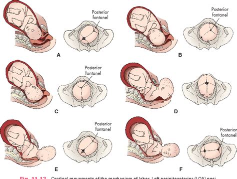 Obstetrics Intrapartum Care Physiomi