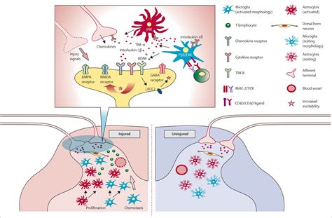The Role Of The Immune System In The Generation Of Neuropathic Pain The Lancet Neurology