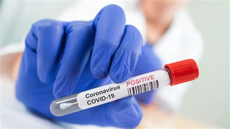 Coronavirus Antibodies Present In Less Than 10 Of Americans Study