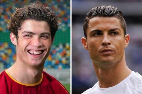 Cristiano Ronaldo Before And After