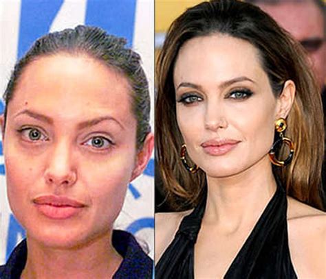 Angelina Jolie Plastic Surgery Before And After Botox Injections Celebie