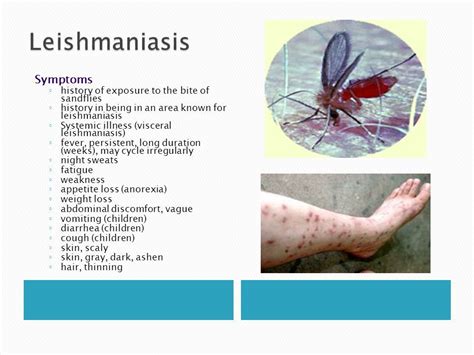 Leishmaniasis Symptoms