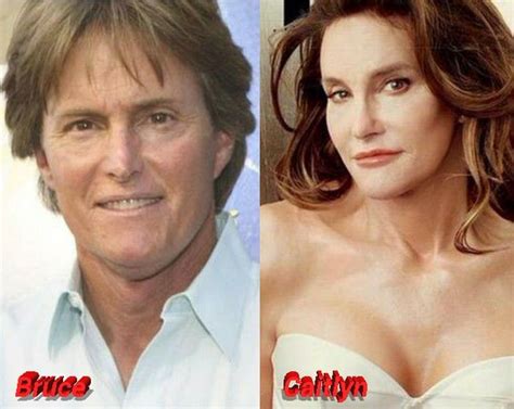 Bruce Jenner Plastic Surgery From Male Athlete To Female Star Bruce