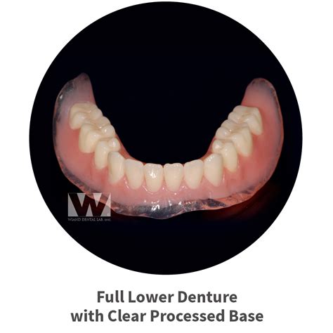 Phoenix Arizona Dentures