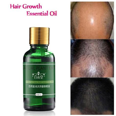 The essential 17 growth oil is used to promote hair growth and a healthy scalp by applying the product directly. Hair Care Hair Growth Essential Oils Essence Original ...