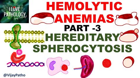 Hemolytic Anemias Part 3 Hereditary Spherocytosis Youtube