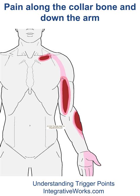 Pin On Rotator Cuff Tendonitis