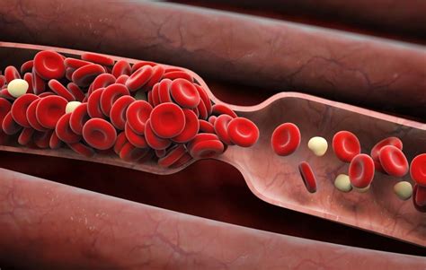 6 Signs You Might Have A Blood Clot