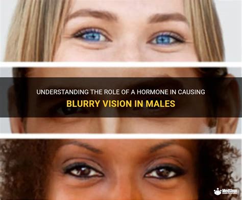 Understanding The Role Of A Hormone In Causing Blurry Vision In Males