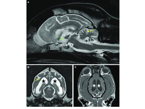 Sagittal Plane Mri