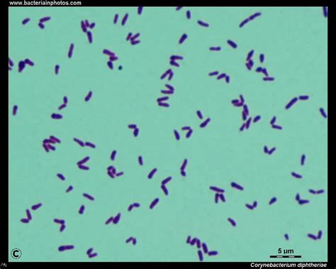 Corynebacterium Diphtheriae Microscopy Purificacion De Air Flickr