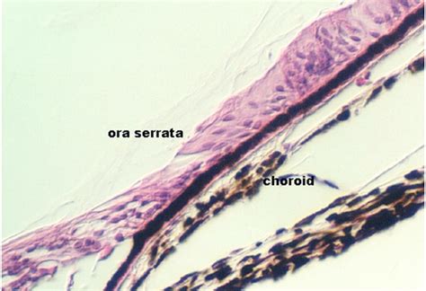 Retina Sclera And Choroid Microanatomy Web Atlas