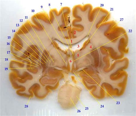 Brain Slice 2 Diagram Quizlet