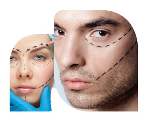 Scar Revision Scar Correction Cleveland Cosmetic Surgery