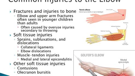 Chapter 7 Common Injuries To The Upper Extremity Youtube