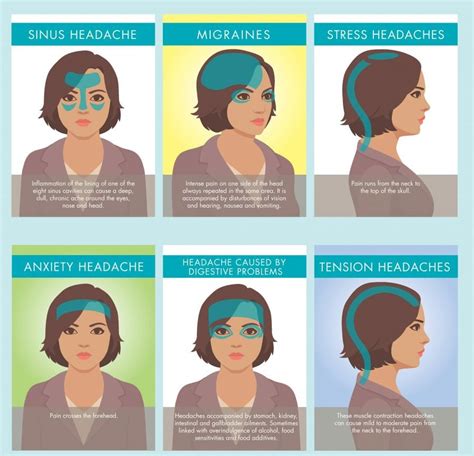 Resize Types Of Headaches Milton Chiropractic Clinic