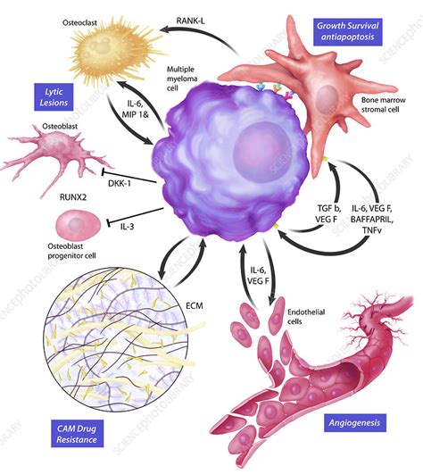 Multiple Myeloma In The Bone Marrow Microenvironment Stock Image