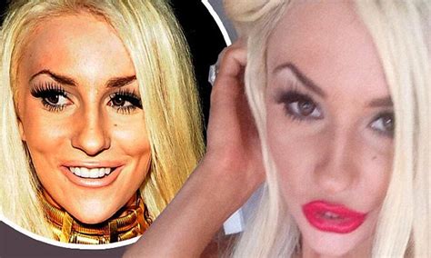 Courtney Stodden Shows Off Her Larger Than Life Trout Pout After