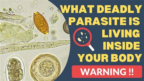 Don T Ignore These Early Symptoms Of Parasites In Your Body What Is Th Parasite Infections