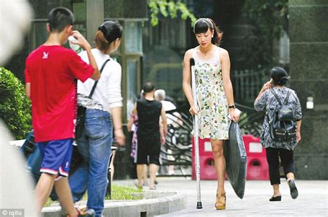 One Legged Chinese Woman Who Wears High Heels Performs In Duet Daily