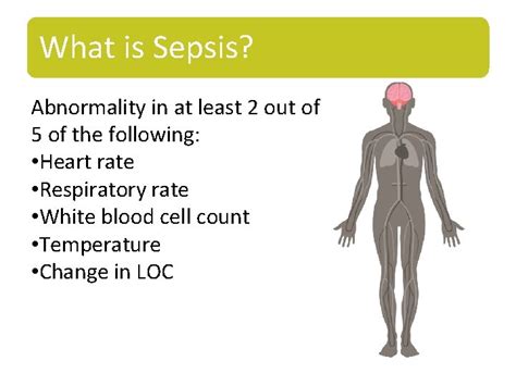 Identifying And Responding To Sepsis Bc Sepsis Inpatient