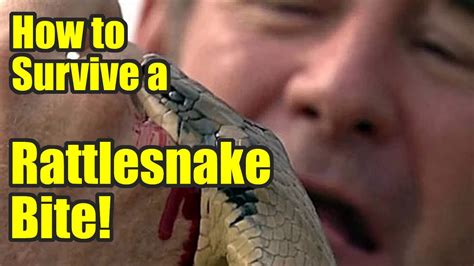 How To Survive A Rattlesnake Bite Youtube