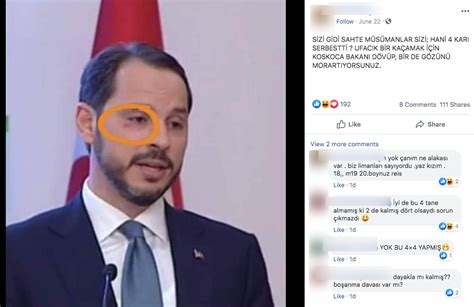 Berat Albayrak ın Gözünün Altındaki Kızarıklığı Gösteren Fotoğraf 2018 Yılından