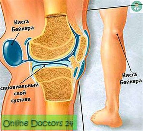 Die jeweilige lokalisation des schmerzes kann mitunter hinweise auf die zugrundeliegende ursache geben. Beinverletzung am Knie: Mögliche Ursachen, Symptome ...