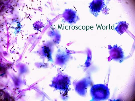 Microscope World Blog Mold Under The Microscope