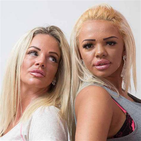 Mom Daughter Duo Drop 80000 On Plastic Surgery Together E Online