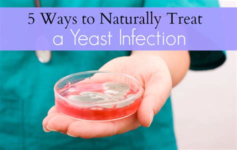 Top 5 Natural Remedies For Yeast Infection