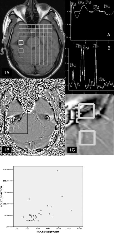 Figure 1 From Usefulness Of Susceptibility Weighted Imaging For Voxel