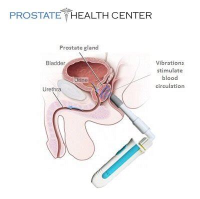 Prostate massage might offer help for prostatitis and other health conditions. Sonic Prostate Health Massager | Best Home Use Prostate ...