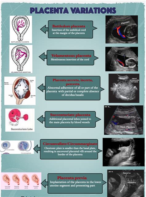 Obstetric Ultrasound Artofit