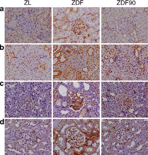 Renal Immunohistochemical Stainings For Tgf β1 Ctgf And Ecm Proteins