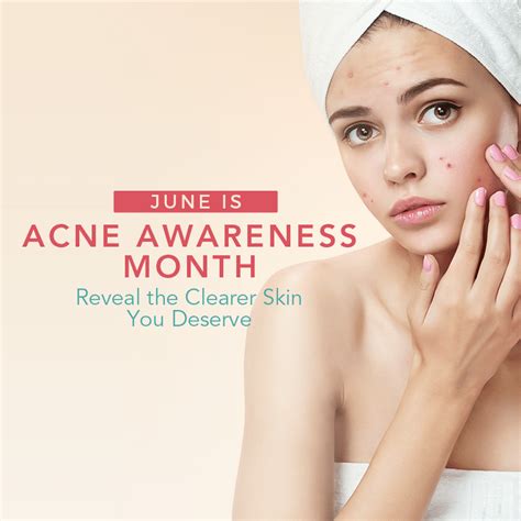Acne Awareness Month Graphic Zel Skin And Laser Specialists