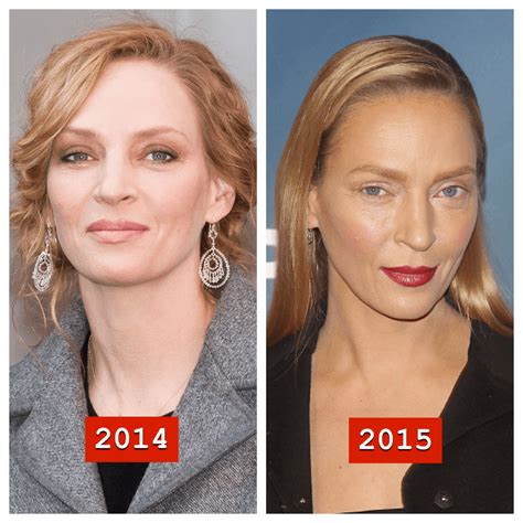 Uma Thurman Has A New Face With Images Plastic Surgery Celebrity