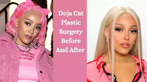 Doja Cat Plastic Surgery Before And After 2024 The Healthstore