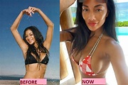 Nicole Scherzinger's plastic surgery - Before and after photos